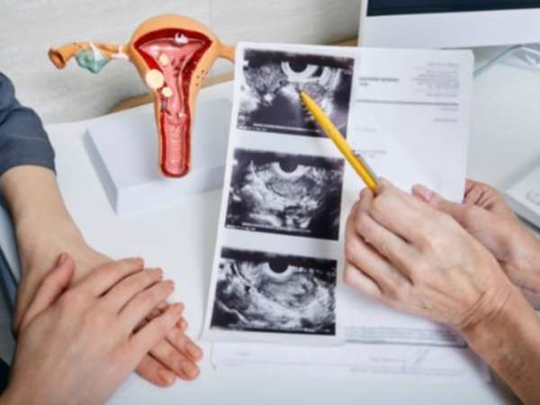 Gestacinis diabetas ir policistinių kiaušidžių sindromas: koks jų ryšys ir ką svarbu žinoti nėštumo&nbsp;metu